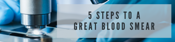 5 Steps To A Great Blood Smear